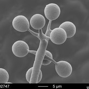 Sporangiophore Plasmopara viticola. A partir de ces petites sphères s’échappent des spores, qui vont coloniser la feuille de vigne et déclencher la maladie du mildiou. (1:2000), ZMB Basel, WBI Frbg.